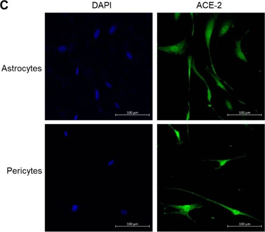 Detection of ACE-2 by Immunocytochemistry/ Immunofluorescence