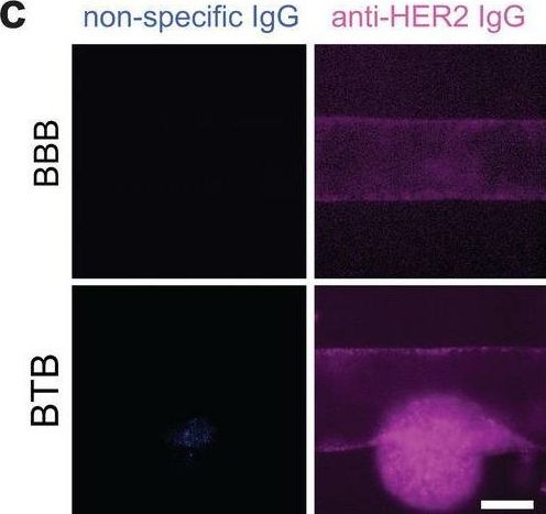 Detection of ErbB2/Her2 by Immunocytochemistry/ Immunofluorescence