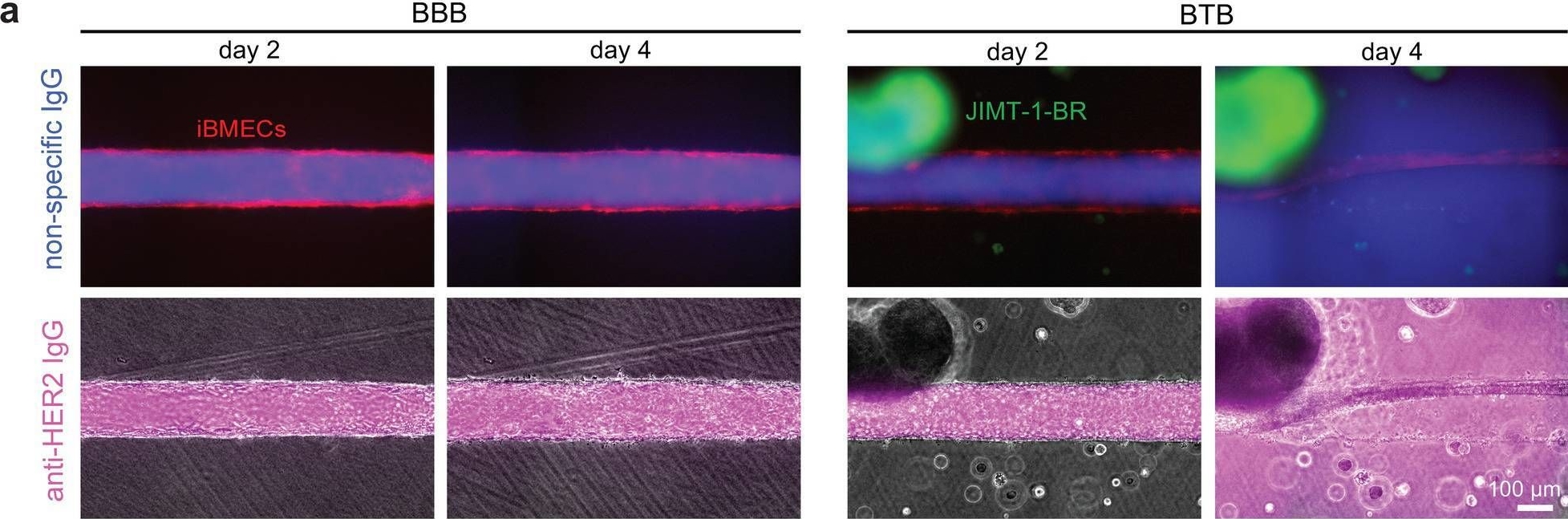 Detection of ErbB2/Her2 by Immunohistochemistry