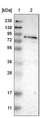 Western Blot: ferric-chelate reductase 1 Antibody [NBP1-90668]