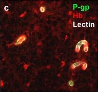 Detection of Human Hemoglobin by Immunohistochemistry