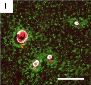 Detection of Human Hemoglobin by Immunohistochemistry