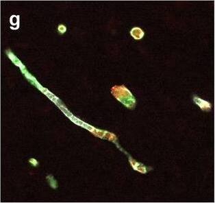 Detection of Human Hemoglobin by Immunohistochemistry