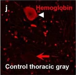 Detection of Human Hemoglobin by Immunohistochemistry