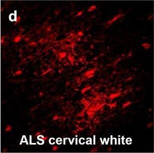 Detection of Human Hemoglobin by Immunohistochemistry