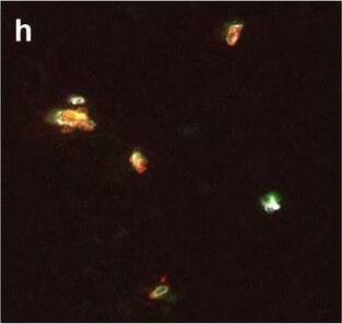 Detection of Human Hemoglobin by Immunohistochemistry