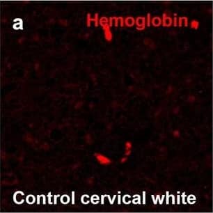 Detection of Human Hemoglobin by Immunohistochemistry