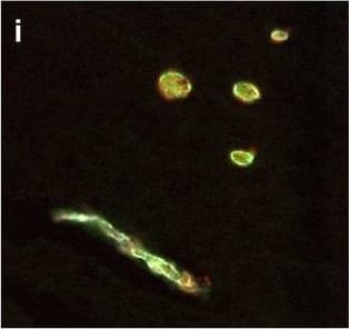 Detection of Human Hemoglobin by Immunohistochemistry