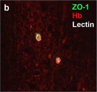 Detection of Human Hemoglobin by Immunohistochemistry