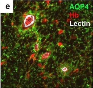 Detection of Human Hemoglobin by Immunohistochemistry