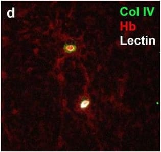 Detection of Human Hemoglobin by Immunohistochemistry