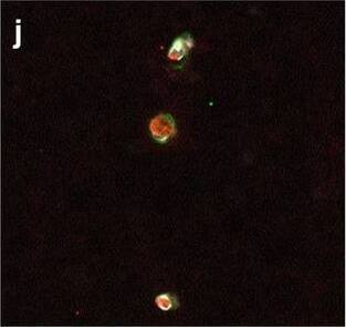 Detection of Human Hemoglobin by Immunohistochemistry