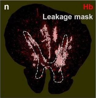 Detection of Human Hemoglobin by Immunohistochemistry