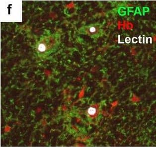 Detection of Human Hemoglobin by Immunohistochemistry
