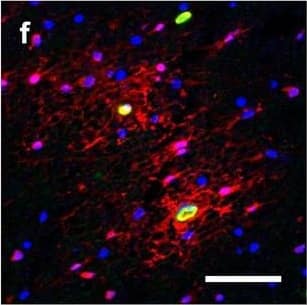 Detection of Human Hemoglobin by Immunohistochemistry