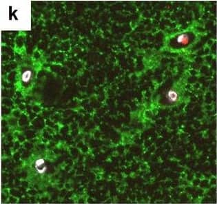 Detection of Human Hemoglobin by Immunohistochemistry