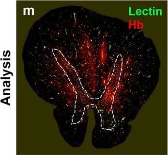Detection of Human Hemoglobin by Immunohistochemistry