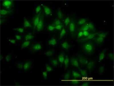 Immunocytochemistry/ Immunofluorescence: gamma-2 Tubulin Antibody (4F6) [H00027175-M01]