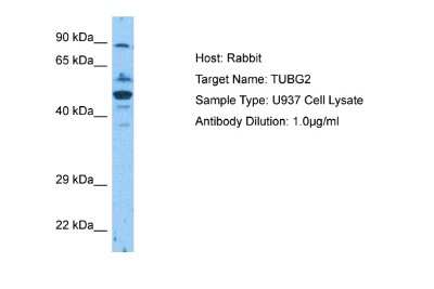 Western Blot: gamma-2 Tubulin Antibody [NBP2-86644]