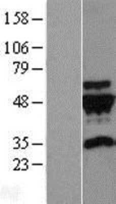 Western Blot: gamma-2 Tubulin Overexpression Lysate [NBL1-17445]