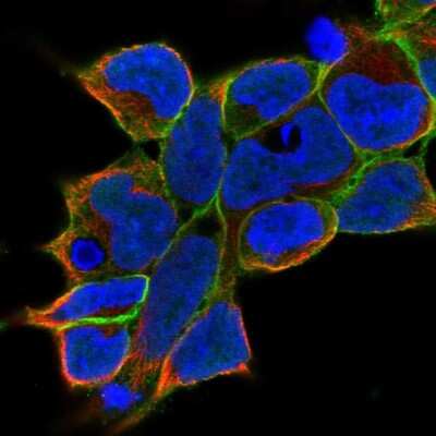 Immunocytochemistry/ Immunofluorescence: gamma Adducin Antibody [NBP2-34017]