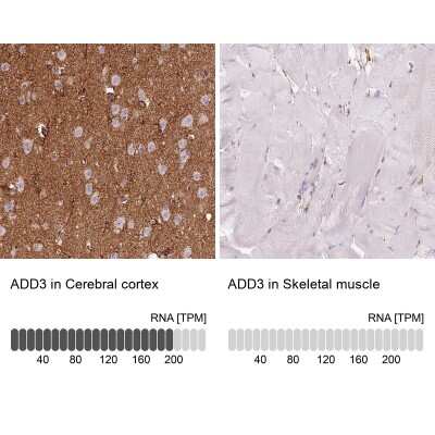 Immunohistochemistry-Paraffin: gamma Adducin Antibody [NBP2-34017]