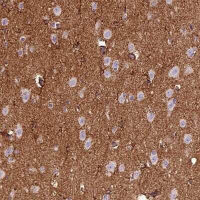 Immunohistochemistry-Paraffin: gamma Adducin Antibody [NBP2-34017]
