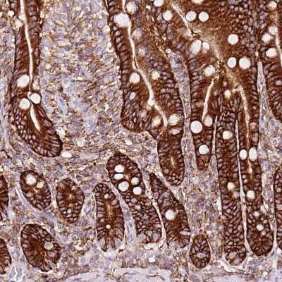 Immunohistochemistry-Paraffin: gamma Adducin Antibody [NBP2-34017]