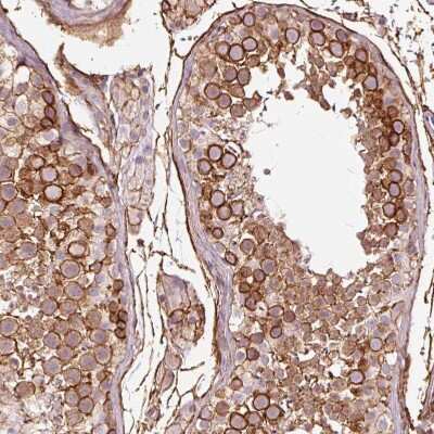 Immunohistochemistry-Paraffin: gamma Adducin Antibody [NBP2-34017]