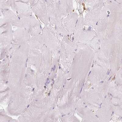 Immunohistochemistry-Paraffin: gamma Adducin Antibody [NBP2-34017]