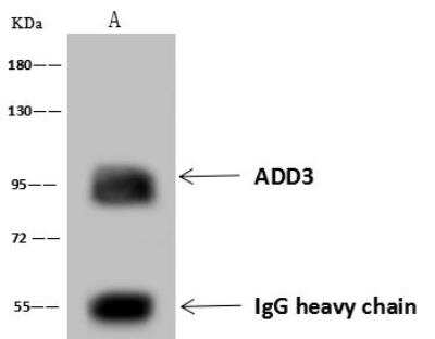Immunoprecipitation: gamma Adducin Antibody [NBP3-12551]
