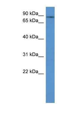 Western Blot: gamma Adducin Antibody [NBP1-79783]