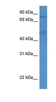 Western Blot: gamma Adducin Antibody [NBP1-79784]