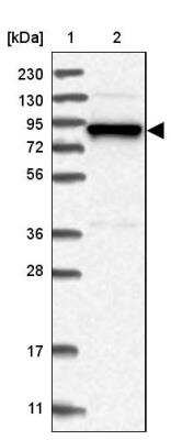 Western Blot: gamma Adducin Antibody [NBP2-34017]