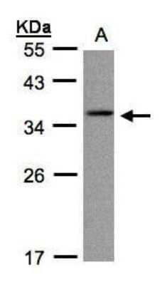 Western Blot: gamma C Crystallin Antibody [NBP1-32557]