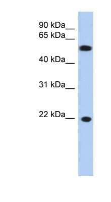 Western Blot: gamma C Crystallin Antibody [NBP1-52908]