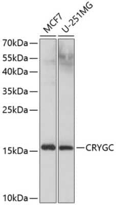 Western Blot: gamma C Crystallin AntibodyBSA Free [NBP3-03301]