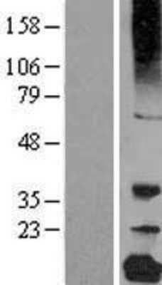 Western Blot: gamma C Crystallin Overexpression Lysate [NBL1-09501]