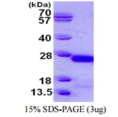 SDS-PAGE: Recombinant Human gamma C Crystallin His Protein [NBP1-98998]