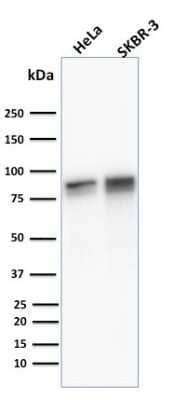 Western Blot: gamma Catenin Antibody ([11E4])Azide and BSA Free [NBP2-54528]