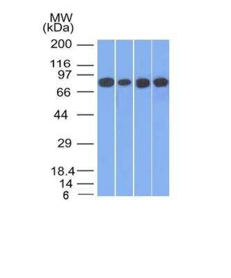 Western Blot: gamma Catenin Antibody ([11E4]) [NBP2-53306]