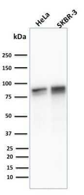 Western Blot: gamma Catenin Antibody ([11E4]) [NBP2-53306]