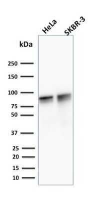 Western Blot: gamma Catenin Antibody (15F11)Azide and BSA Free [NBP2-54527]