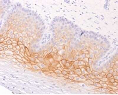 Immunohistochemistry-Paraffin: gamma Catenin Antibody (15F11) [NBP2-53325]
