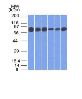 Western Blot: gamma Catenin Antibody (15F11) [NBP2-53325]
