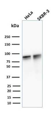 Western Blot: gamma Catenin Antibody (15F11) [NBP2-53325]