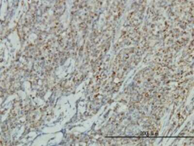 Immunohistochemistry-Paraffin: gamma Catenin Antibody (2G9) [H00003728-M01]