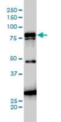 Western Blot: gamma Catenin Antibody (2G9) [H00003728-M01]