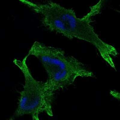 Immunocytochemistry/ Immunofluorescence: gamma Catenin Antibody (4C12) - BSA Free [NBP2-37557]
