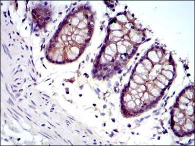 Immunohistochemistry: gamma Catenin Antibody (4C12) - BSA Free [NBP2-37557]